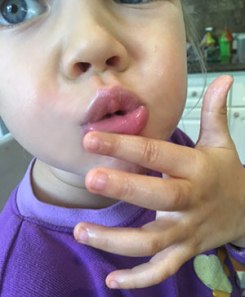 img_4226-face-rev-300